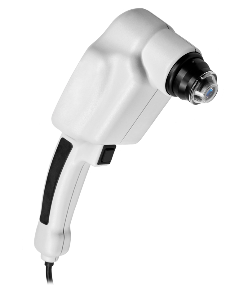 VivaScope 3000 handheld Confocal laser scan Microscopy, included in the VivaScope 1500 3000 system