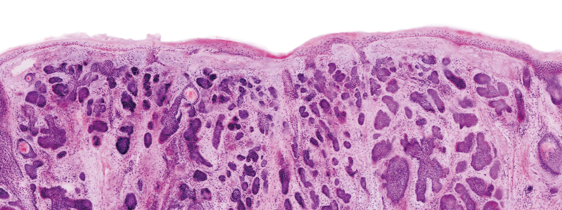 VivaScope 2500 ex vivo dermatology skin