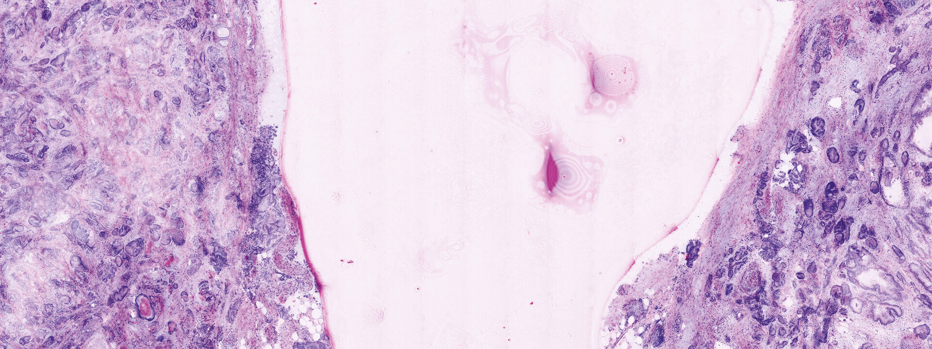 Confocal Image ex vivo application type 2