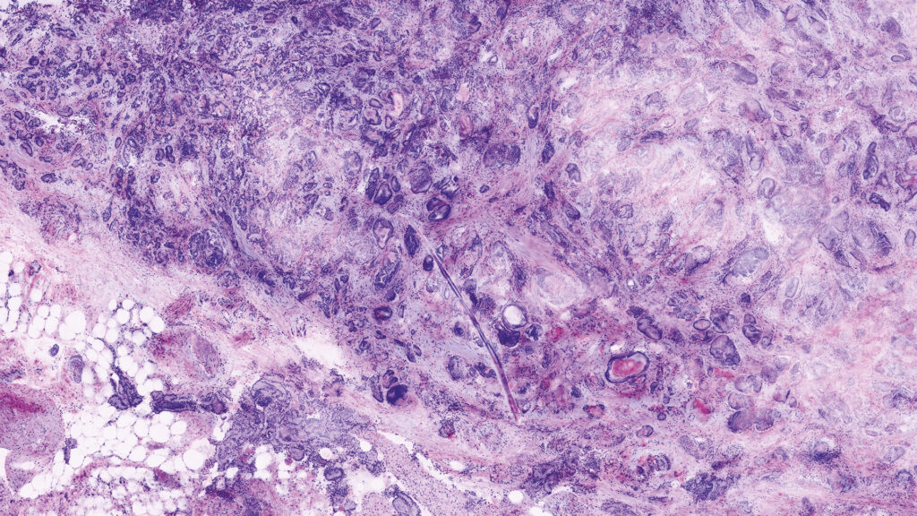Confocal Laser Scan images compared to H&E pictures.