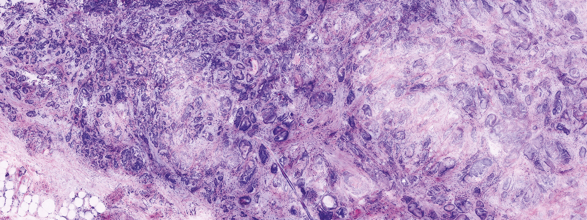 VivaScope 2500 ex vivo scan confocal example scan 3