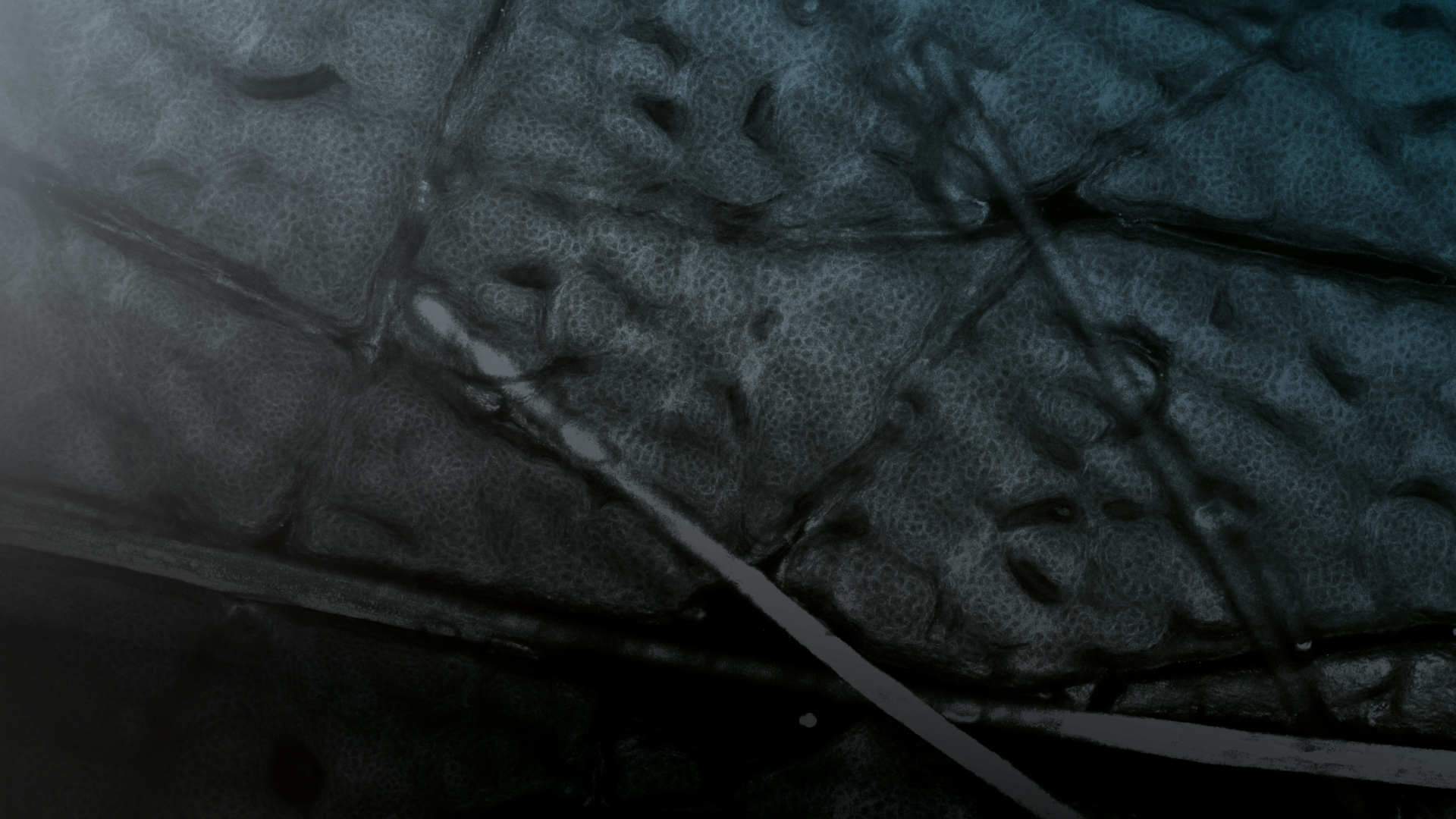 VivaScope 1500 Background