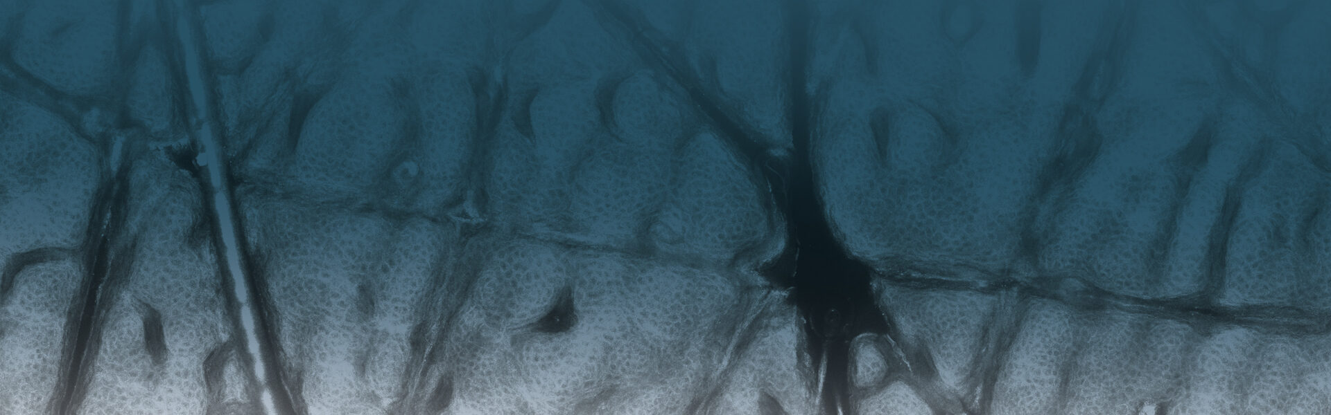 Find Centers for VivaScope Confocal Microscopy