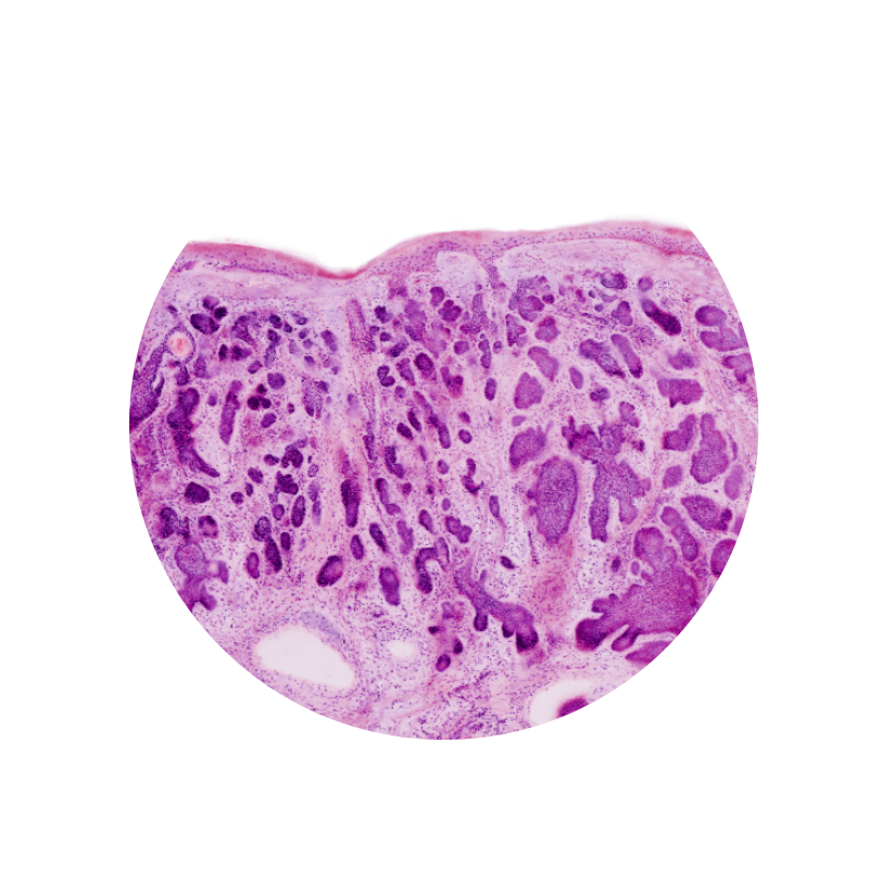 VivaScope 2500 confocal image example 1 (ex vivo technology)