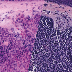 H&E-like images during surgery. Within minutes. Immediate results possible.