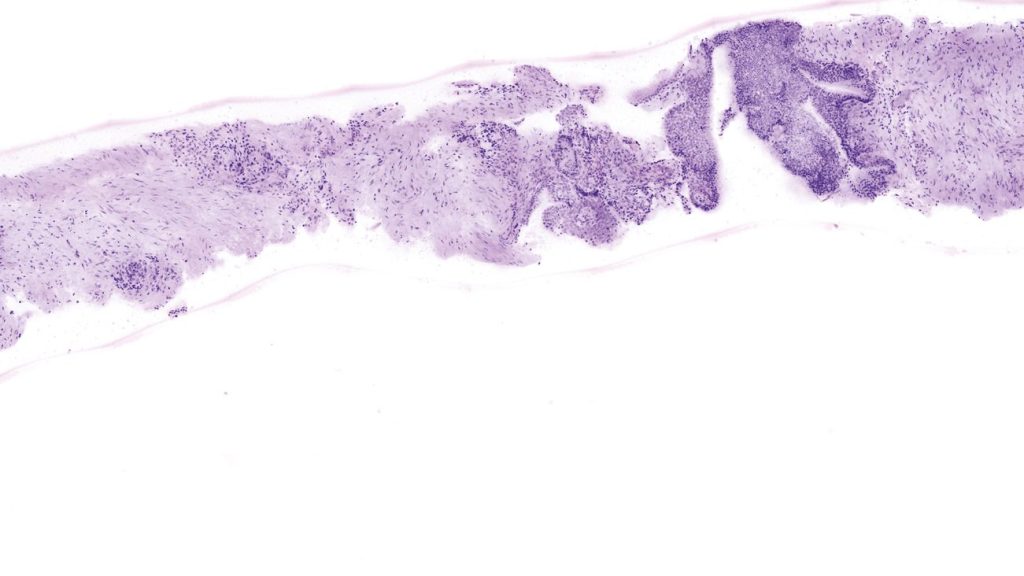VivaScope 2500 confocal image example 3